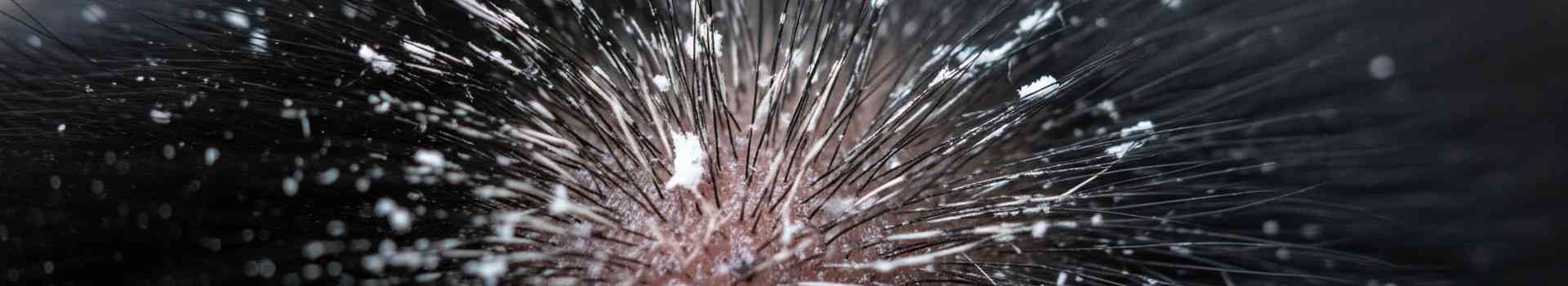 Dermatite seborroica nel cane: come migliorare la qualità della sua pelle